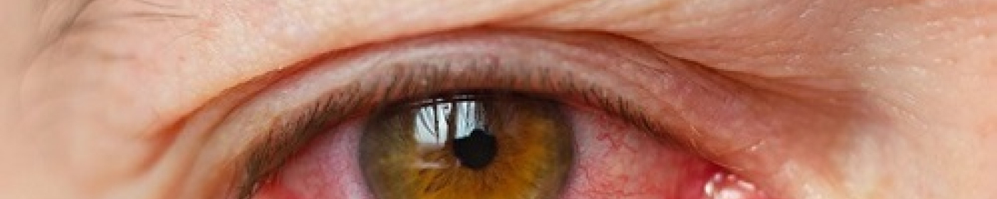 GÖZ KURULUĞUNA KARŞI DAMLA TEDAVİSİ